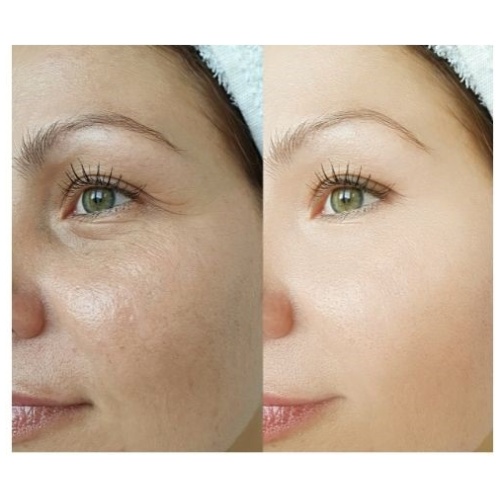 BODYCLEAR SUPER FACE LIGHTENING CREAM  100% NATURAL INGREDIENTS 50ml