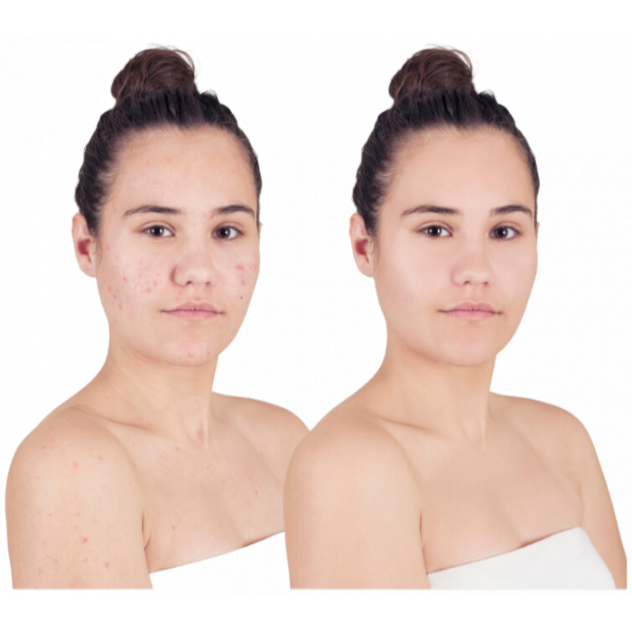 Advanced Intense Dark Spot Correcting Cream - Image 3